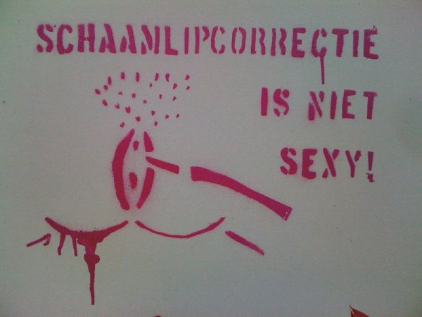 Schaamlipcorrectie is niet sexy